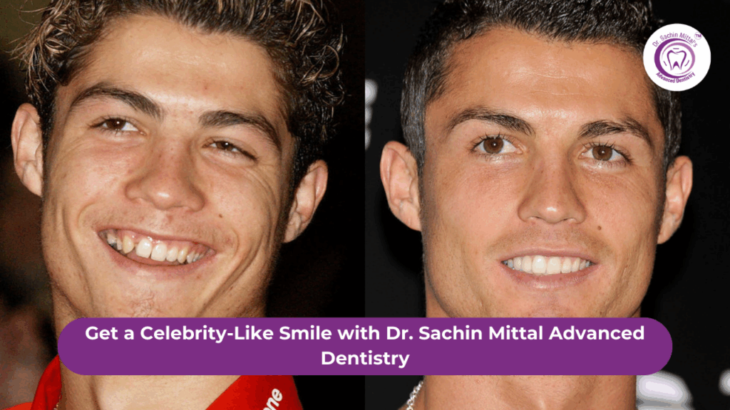 Celebrity-Like Smile