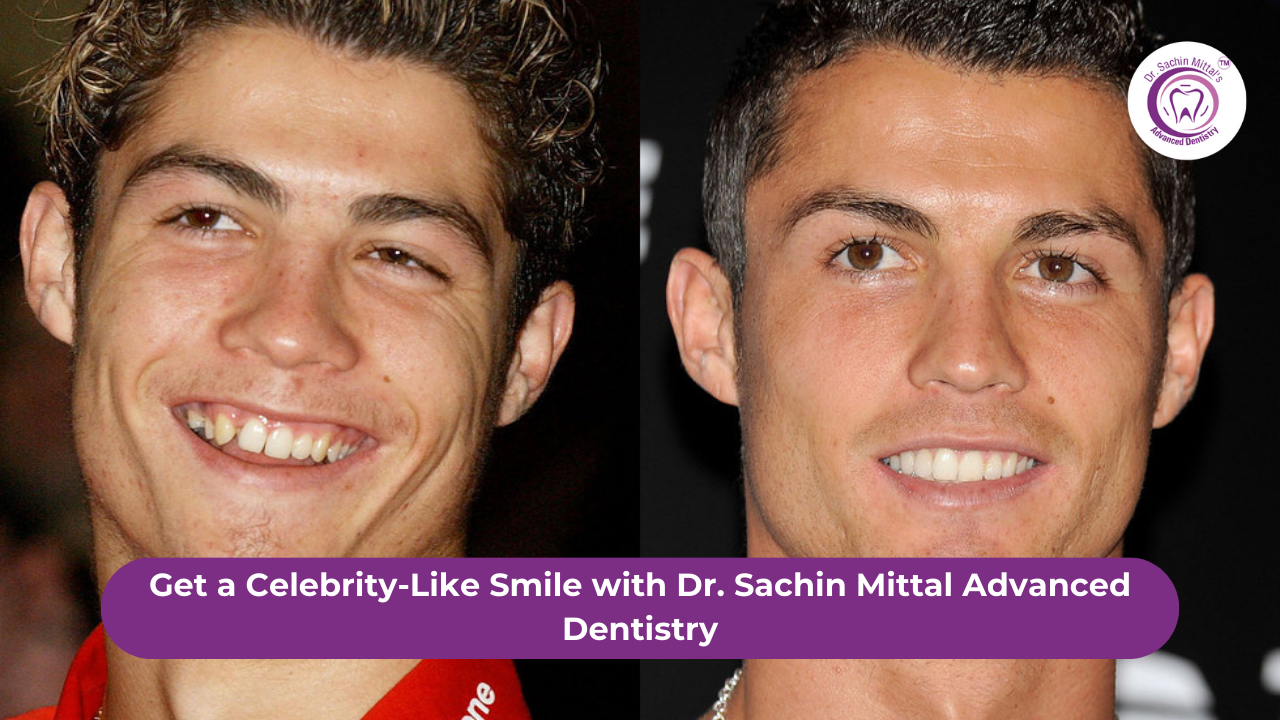 Get a Celebrity Like Smile with Dr. Sachin Mittal Advanced Dentistry