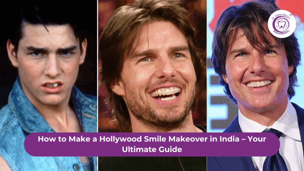 Hollywood Smile Makeover