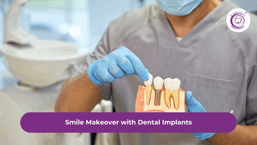 Smile Makeover with Dental Implants