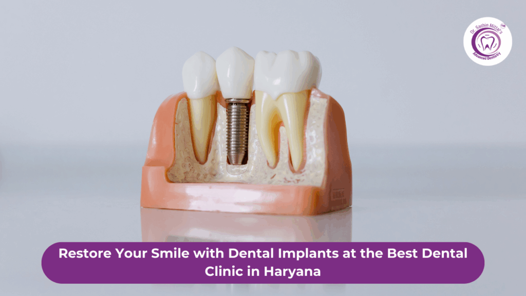 Dental Implants and Teeth Whitening