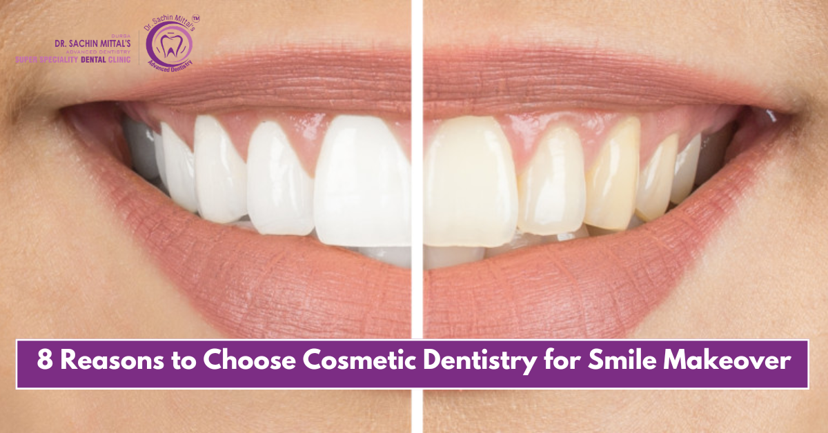 8 Reasons to Choose Cosmetic Dentistry for Smile Makeover