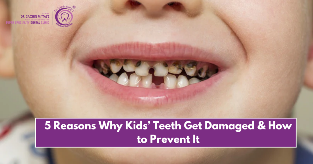 5 Reasons Why Kids’ Teeth Get Damaged & How to Prevent It