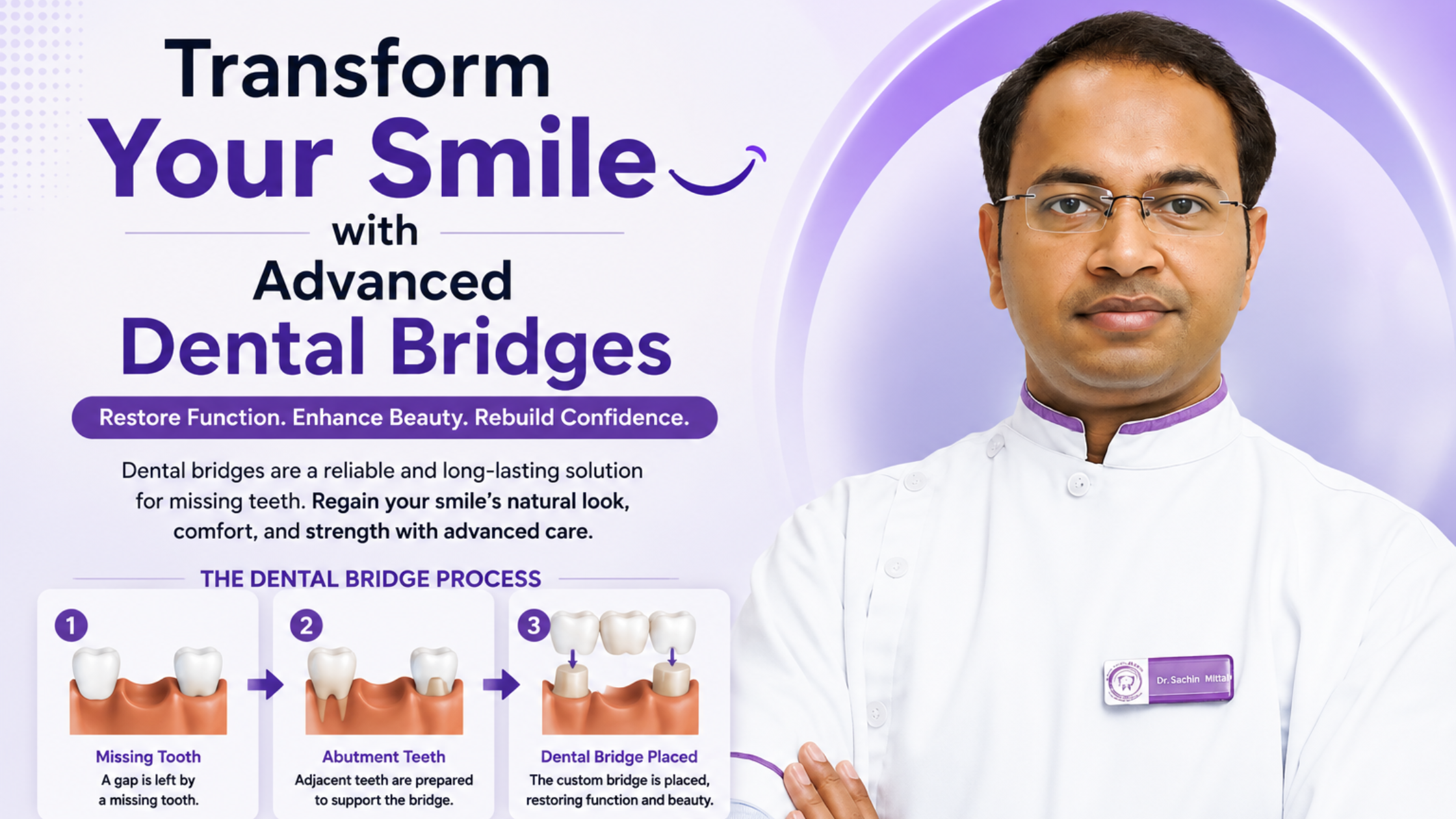 Transform Your Smile with Advanced Dental Bridges