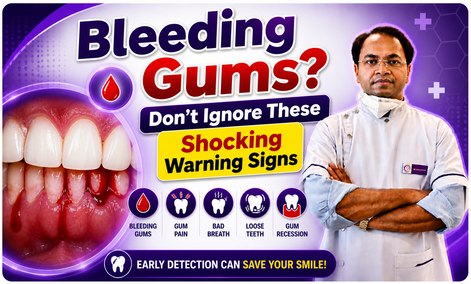 Bleeding Gums? Don’t Ignore These Shocking Warning Signs